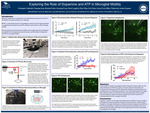 Exploring the Role of Dopamine and ATP in Microglial Motility