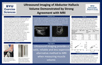 Ultrasound Imaging of Abductor Hallucis Volume Demonstrated by Strong Agreement with MRI